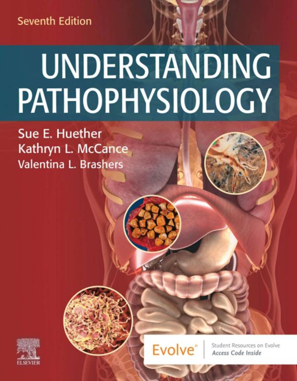 Understanding Pathophysiology 7th Edition Test Bank by Sue Huether and Kathryn McCance